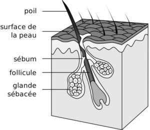 acné peau ado